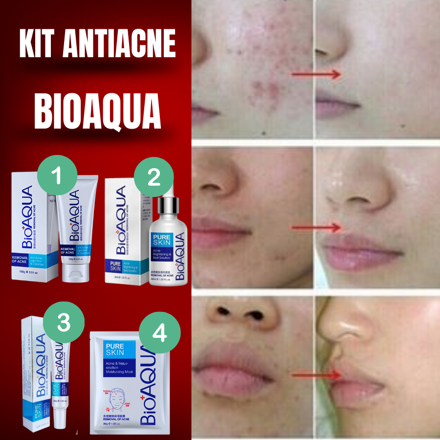 KIT BIOAQUA ACNÉ